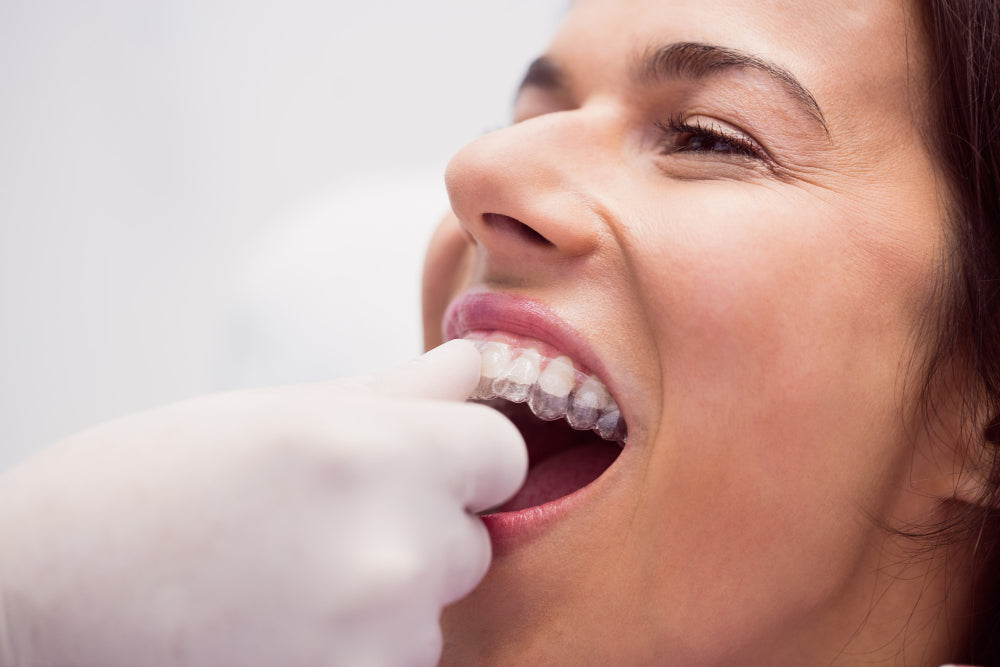Clear Aligners for Teens vs. Adults: What's the Difference?