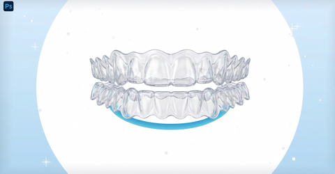 How SmilePerfect Aligners Are Custom-Made for Your Smile