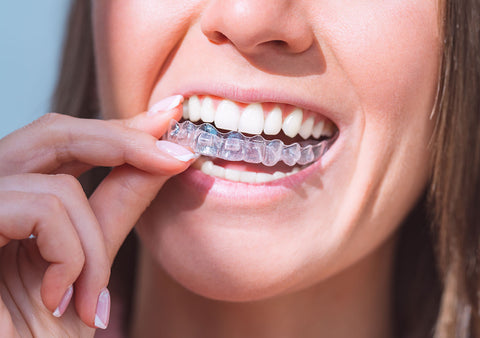 Smile Perfect Clear Aligners: A Smarter Way to Straighten Your Smile